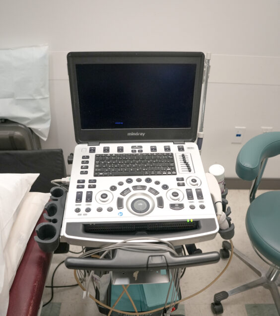 Close-up of an echocardiogram machine that is used for displaying heart images on the screen, for diagnosing heart conditions.